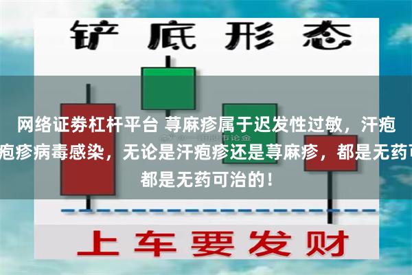 网络证劵杠杆平台 荨麻疹属于迟发性过敏，汗疱疹属于疱疹病毒感染，无论是汗疱疹还是荨麻疹，都是无药可治的！